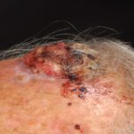 Online course aims to raise awareness of construction-related occupational cancers